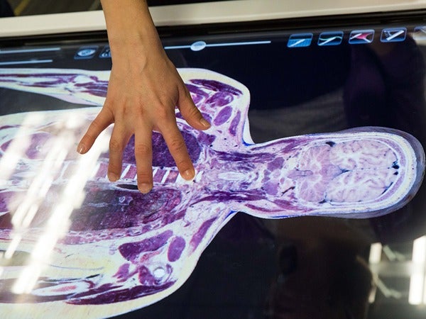 A hand interacting with a digital anatomical display on a touchscreen.