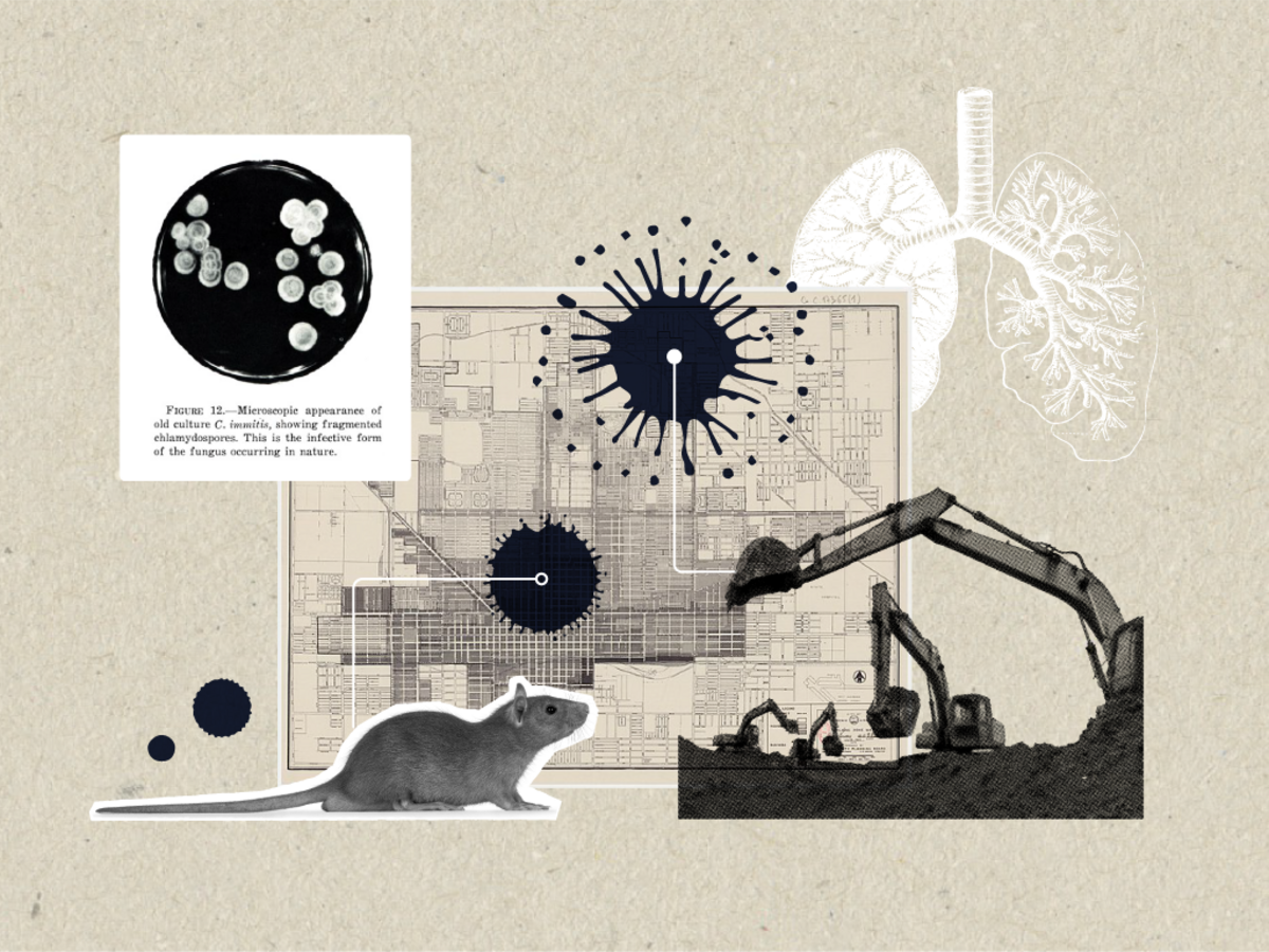 Collage image of microscopic view of C. immitis, a rat, excavators at a dig site, lungs, and a blueprint